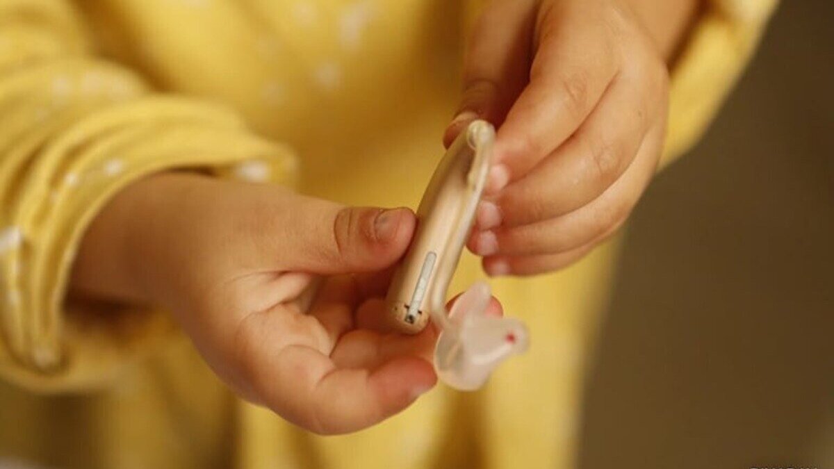 Rajasthan sees first AI-based Cochlear Implant surgery at govt hospital; procedure performed on 3-year-old girl