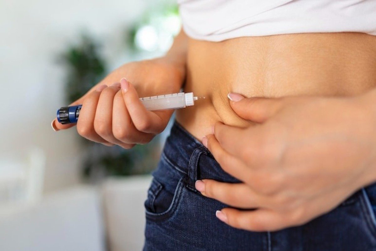 Representative image