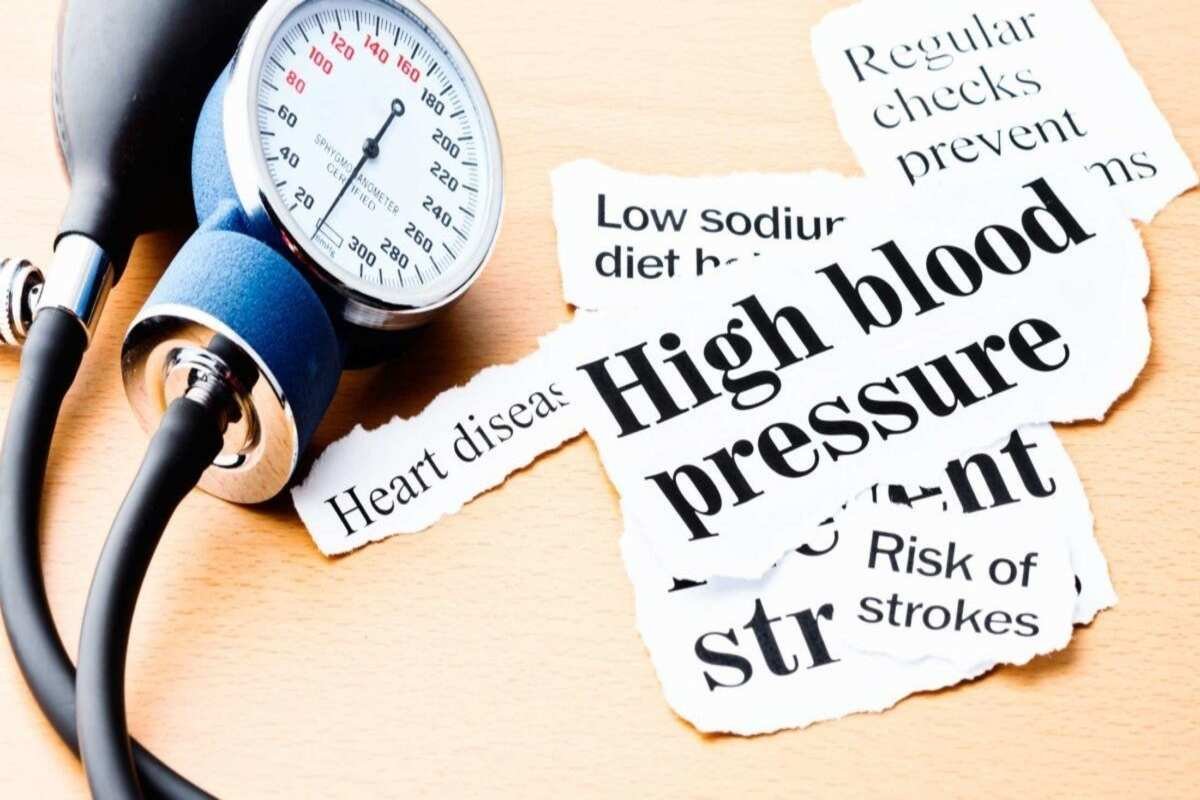 Representative image