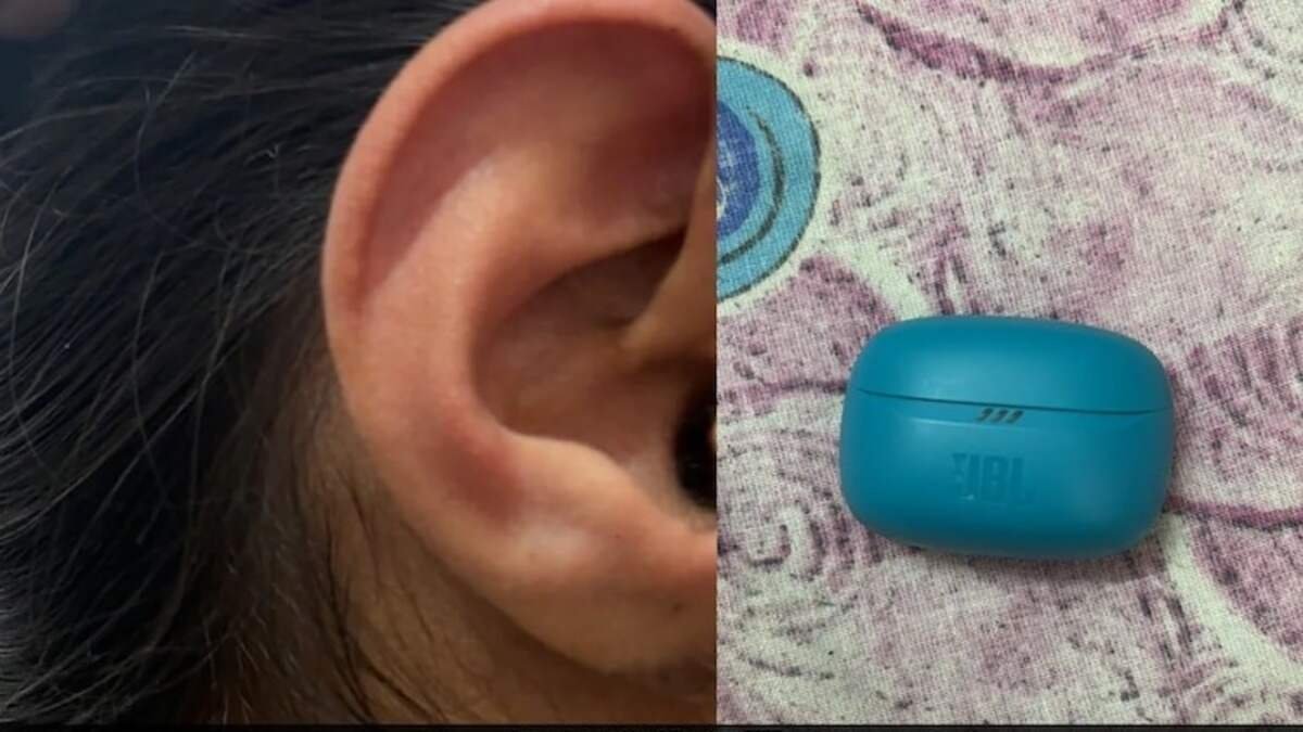 Rajasthan student alleges JBL earbud burst inside her ear, leading to eardrum’s inflammation; shares pics online