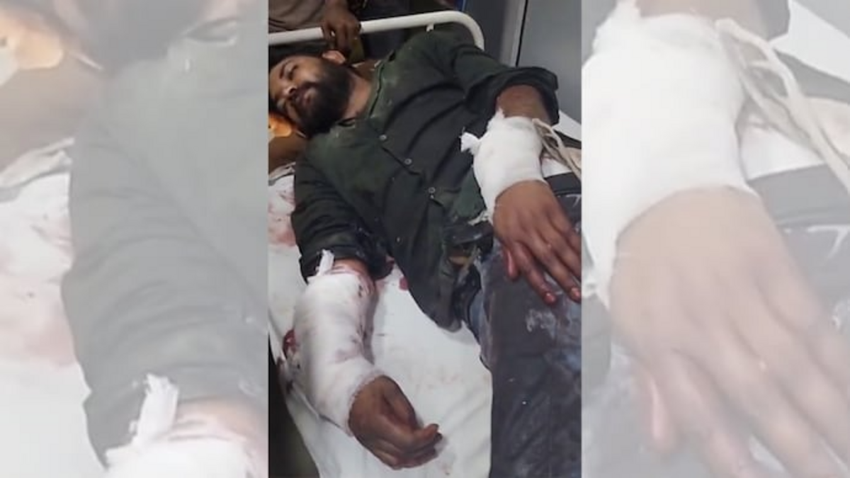 Delhi: Confectioner tied up, cuts inflicted on hands with grinder over monetary dispute; 3 including 2 juveniles held