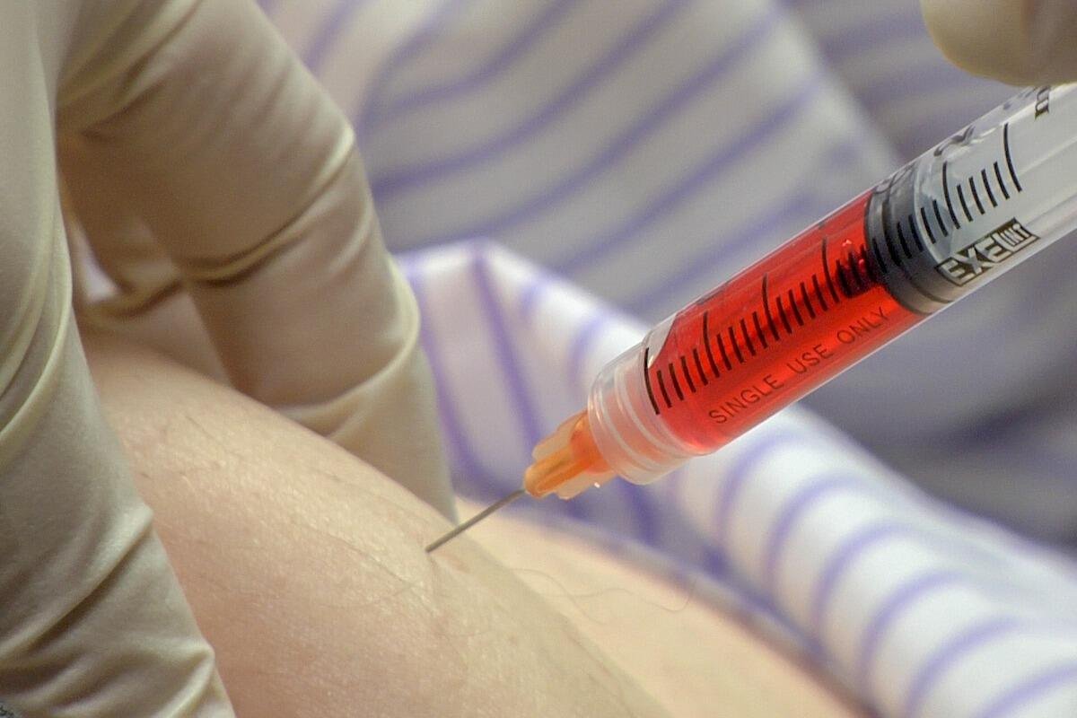 Representative image