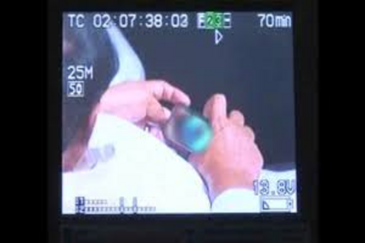 Representative image