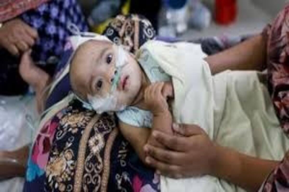 An infant affected by Measles in Bangladesh